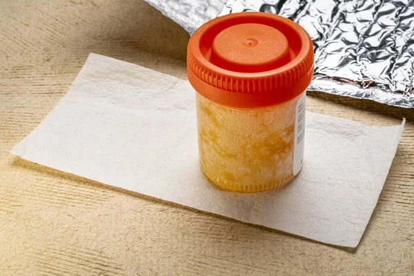 冷凍尿サンプルは サーモバッグの研究室に郵送する準備ができています 家庭の健康テストの概念 — ストック写真