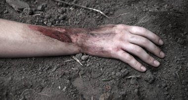 Rus kuvvetleri gardını kaybetti, erkek adam yaralandı, silah ateşlendi, hayat boyu acı çekti, travma geçirdi, kara tarla düştü, korkunç bir korku, Rusya 'nın kanaması var, yaralı yardım, yaralı sağlık görevlisi, kahraman.