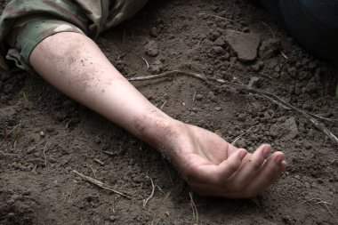 Rus kuvvetleri gardını kaybetti, erkek adam yaralandı, silah ateşlendi, hayat boyu acı çekti, travma geçirdi, kara tarla düştü, korkunç bir korku, Rusya 'nın kanaması var, yaralı yardım, yaralı sağlık görevlisi, kahraman.