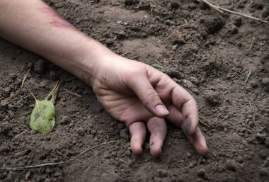Rus kuvvetleri gardını kaybetti, erkek adam yaralandı, silah ateşlendi, hayat boyu acı çekti, travma geçirdi, kara tarla düştü, korkunç bir korku, Rusya 'nın kanaması var, yaralı yardım, yaralı sağlık görevlisi, kahraman.