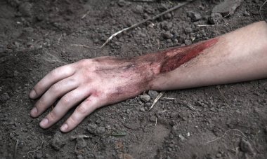 Rus kuvvetleri gardını kaybetti, erkek adam yaralandı, silah ateşlendi, hayat boyu acı çekti, travma geçirdi, kara tarla düştü, korkunç bir korku, Rusya 'nın kanaması var, yaralı yardım, yaralı sağlık görevlisi, kahraman.
