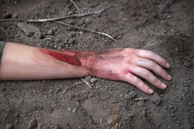 Rus kuvvetleri gardını kaybetti, erkek adam yaralandı, silah ateşlendi, hayat boyu acı çekti, travma geçirdi, kara tarla düştü, korkunç bir korku, Rusya 'nın kanaması var, yaralı yardım, yaralı sağlık görevlisi, kahraman.