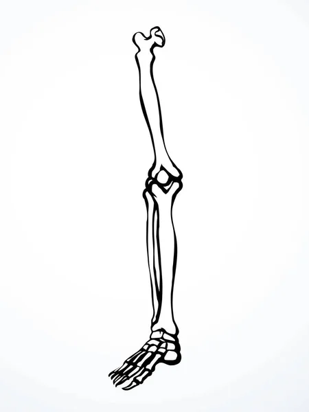 前视老年妇女病伤脚趾肌组织部分疼痛医院外科护理扫描X射线半径白色标志黑色手绘股骨上腓骨踝关节损伤X射线病痛检查线草图艺术 — 图库矢量图片
