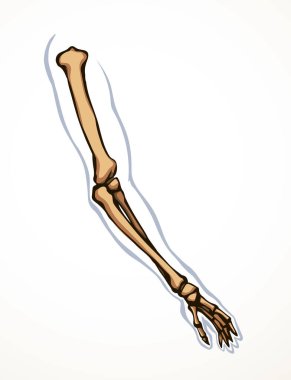 Arkaya bakan hasta kadın, omurga yaralanması bilek ağrısı, ameliyat, terap tarama, röntgen, beyaz logo. Siyah çizilmiş kadın yaralanması başparmak sıhhiyesi, Xray dirsek ağrısı, dirsek ağrısı, çizim sanatı.