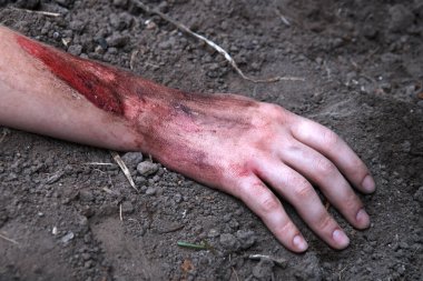 Rus kuvvetleri gardını kaybetti, erkek adam yaralandı, silah ateşlendi, hayat boyu acı çekti, travma geçirdi, kara tarla düştü, korkunç bir korku, Rusya 'nın kanaması var, yaralı yardım, yaralı sağlık görevlisi, kahraman.