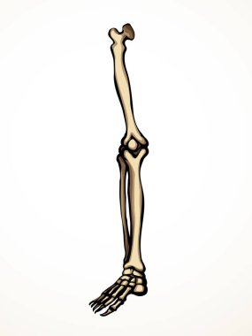 Önde yaşlı bir kadın hasta, ayak parmağı yaralanması, kas dokusu, göğüs ağrısı, hastane bakımı, x ışını yarıçapı, beyaz logo, siyah el, üst fibular bilek zedelenmesi, sıhhhiye, röntgen, acı çizimi, resim çizimi.