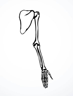 Arkaya bakan hasta kadın, omurga yaralanması bilek ağrısı, ameliyat, terap tarama, röntgen, beyaz logo. Siyah çizilmiş kadın yaralanması başparmak sıhhiyesi, Xray dirsek ağrısı, dirsek ağrısı, çizim sanatı.