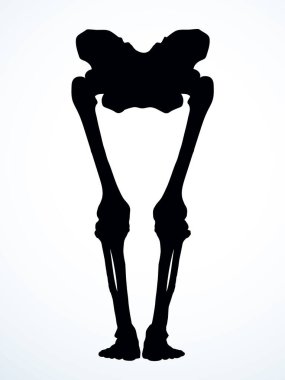 Önde yaşlı bir kadın hasta, ayak parmağı yaralanması, kas dokusu, göğüs ağrısı, hastane bakımı, x ışını yarıçapı, beyaz logo, siyah el, üst fibular bilek zedelenmesi, sıhhhiye, röntgen, acı çizimi, resim çizimi.