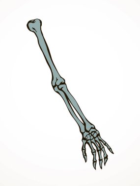 Arkaya bakan hasta kadın, omurga yaralanması bilek ağrısı, ameliyat, terap tarama, röntgen, beyaz logo. Siyah çizilmiş kadın yaralanması başparmak sıhhiyesi, Xray dirsek ağrısı, dirsek ağrısı, çizim sanatı.