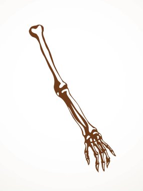 Arkaya bakan hasta kadın, omurga yaralanması bilek ağrısı, ameliyat, terap tarama, röntgen, beyaz logo. Siyah çizilmiş kadın yaralanması başparmak sıhhiyesi, Xray dirsek ağrısı, dirsek ağrısı, çizim sanatı.