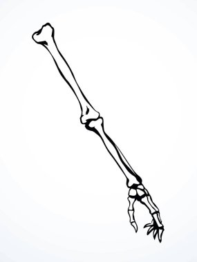 Arkaya bakan hasta kadın, omurga yaralanması bilek ağrısı, ameliyat, terap tarama, röntgen, beyaz logo. Siyah çizilmiş kadın yaralanması başparmak sıhhiyesi, Xray dirsek ağrısı, dirsek ağrısı, çizim sanatı.