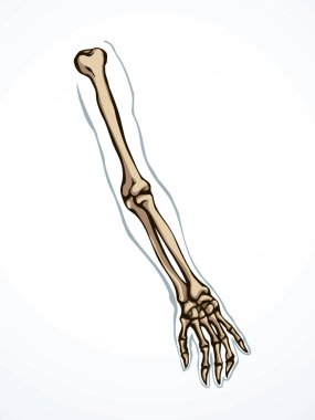 Arkaya bakan hasta kadın, omurga yaralanması bilek ağrısı, ameliyat, terap tarama, röntgen, beyaz logo. Siyah çizilmiş kadın yaralanması başparmak sıhhiyesi, Xray dirsek ağrısı, dirsek ağrısı, çizim sanatı.