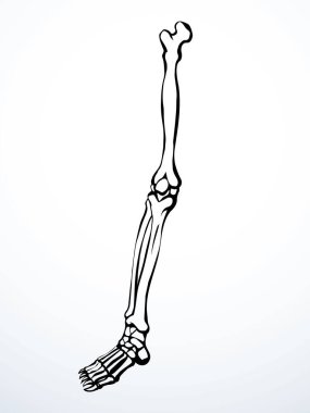 Önde yaşlı bir kadın hasta, ayak parmağı yaralanması, kas dokusu, göğüs ağrısı, hastane bakımı, x ışını yarıçapı, beyaz logo, siyah el, üst fibular bilek zedelenmesi, sıhhhiye, röntgen, acı çizimi, resim çizimi.