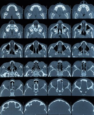 Beyin taraması farklı bir seviyede. 3d xray beyin ekranı