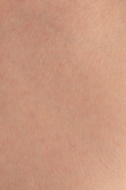 Noktalı pürüzlü insan derisi. Yakın görüş.