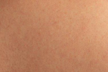 Cilt dokusunun yakın çekimi, doğal gözenekler, ve yumuşak ışıklandırma altında pürüzsüz yüzey, cilt sağlığı vurgusu.