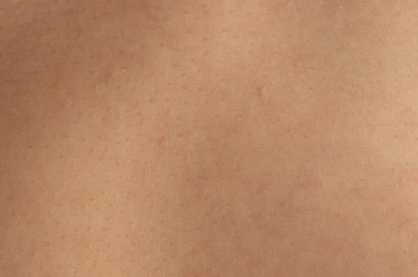 Gözenekler yakın görünüm ile beyaz insan deri dokusu arka planı