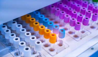 Hitech biyokimya laboratuvar ekipmanları laboratuardaki biyolojik deneyler için test tüpü ile yakın çekim