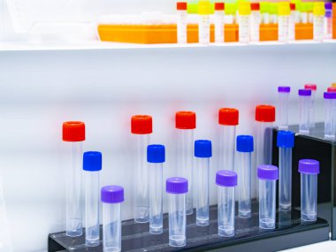 Hitech biyokimya laboratuvar ekipmanları laboratuardaki biyolojik deneyler için test tüpü ile yakın çekim