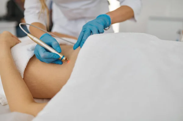Primer Plano Electro Epilyatología Procedimiento Cosmetología Para Depilación Del Abdomen — Foto de Stock