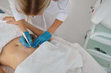 Kadın karnındaki kılların alınması için yakın çekim elektro epilasyon kozmetik prosedürü. Tıbbi bakım