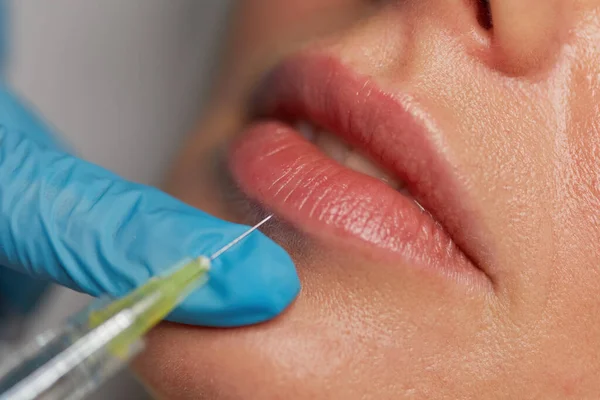 Cosmetology augmentation injection to increase lips shape. Closeup syringe with needle over female mouth