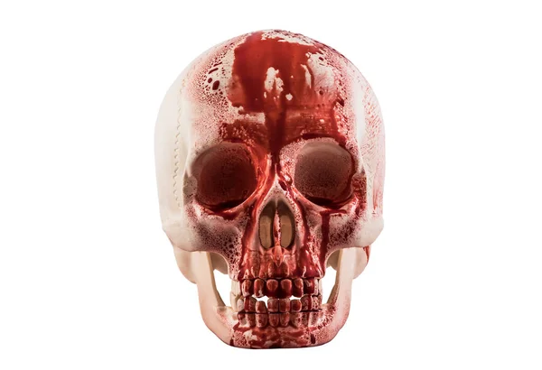 Menschlicher Schädel Blut Isoliert Auf Weißem Hintergrund Mit Schneideweg — Stockfoto