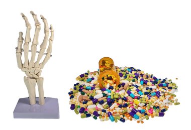 Tıbbi omurga ve el modeli ağrıyı azaltmak için verilen reçeteli ilaçlarla farklı kısımları gösteriyor.