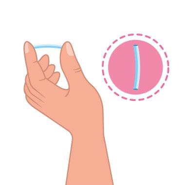 Doğum kontrol implantı tasarım illüstrasyon vektörü