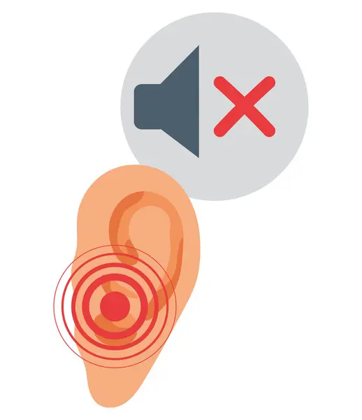 人工耳蜗植入错误隔音 — 图库矢量图片