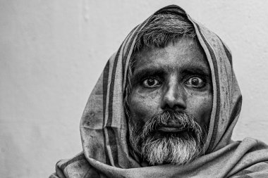Sundarpur, Hindistan - Kasım 2013: Sundarpur, Bihar State, Hindistan 'da yerel bir cüzzam hastanesinde kimliği belirsiz bir Hintli hasta