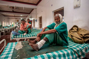 Sundarpur, Hindistan - Kasım 2013: Sundarpur, Bihar State, Hindistan 'da yerel bir cüzzam hastanesinde kimliği belirsiz Hintli cüzzamlı hastalar