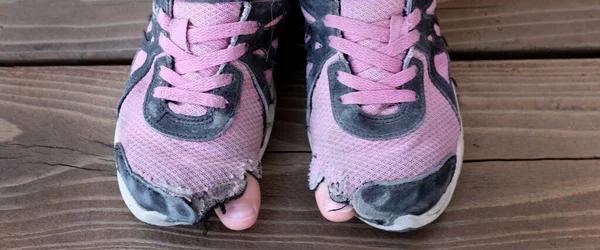 Zapatos Viejos Desgastados Con Agujeros Dedos Los Pies Persona Sin —  Fotos de Stock