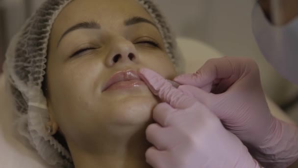 美容院正在做手术的美女 填充注射剂 戴紫色手套的医生在鼻唇褶皱处注射 — 图库视频影像