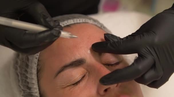 Kosmetolog Označí Perem Místa Pro Zavedení Přípravku Botox Čela Pacientů — Stock video