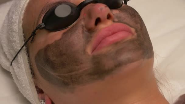 Procedura Curățare Facială Peeling Carbon Într Salon Spa Închide Vizualizarea — Videoclip de stoc