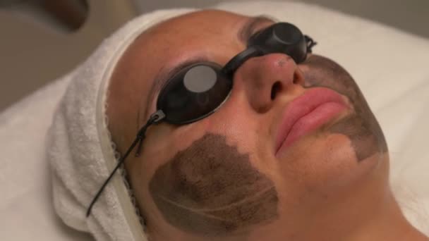 Facial Cleansing Procedure Carbon Peeling Spa Salon Close Top View — Stock Video