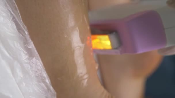 Beautician Removes Hair Beautiful Female Legs Using Laser — Stock Video