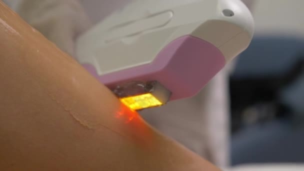 Kosmetyk Usuwa Włosy Pięknych Kobiecych Nogach Pomocą Lasera — Wideo stockowe