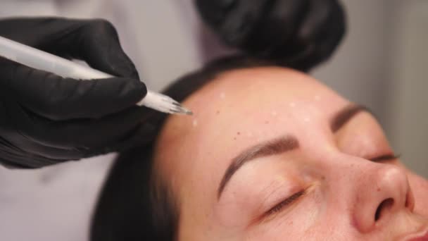 Kosmetická Klinika Kosmetička Ruce Rukavicích Které Dělají Obličej Stárnoucí Injekce — Stock video