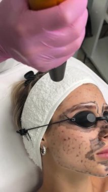 Güzellik uzmanları, güzellik salonundaki bir kanepede uzanan gözlüklü güzel bir müşteriye karbon soyuyorlar. Yüz temizleme konsepti. Kozmetik Hizmetleri. 