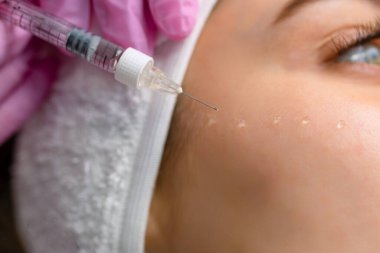 Güzellik salonundaki güzel, rahat kadın elmacık kemiklerine kırışıklık önleyici iğneler vuruluyor. Güzellik salonunda gözleri kapalı yatıyor.. 
