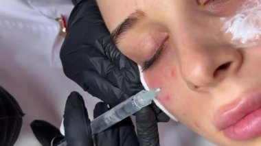 Mezoterapi, biyolojik evrim ve kozmetik konsepti. Güzellik salonunda mezoterapi prosedürüyle yüzleş. Güzellik uzmanı kadın derisine iğne yapıyor.. 