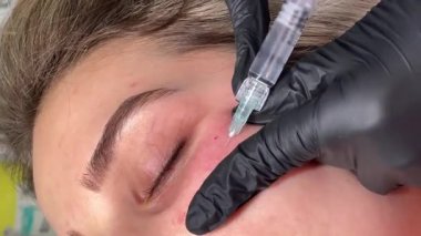 Mezoterapi, biyolojik evrim ve kozmetik konsepti. Güzellik salonunda mezoterapi prosedürüyle yüzleş. Güzellik uzmanı kadın derisine iğne yapıyor.. 