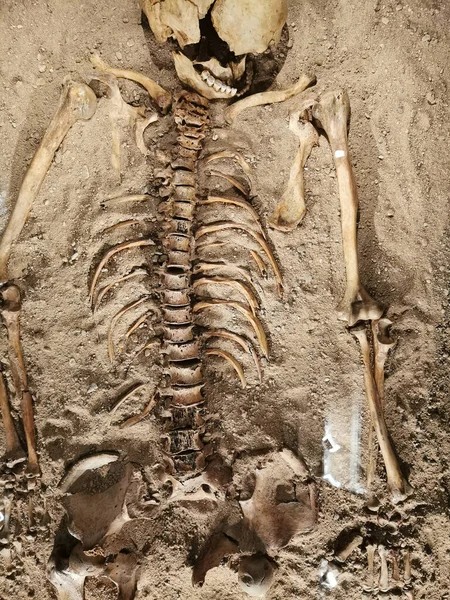 古い人間の骨はとてもいい質感で — ストック写真