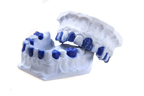 Různé Předměty Zubního Modelu Školy Zubařů — Stock fotografie