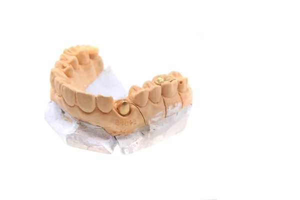 Diversi Oggetti Modello Dente Scuola Dentista — Foto Stock
