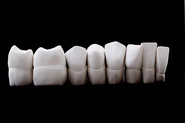 与牙科诊所不同的牙齿模型对象 — 图库照片