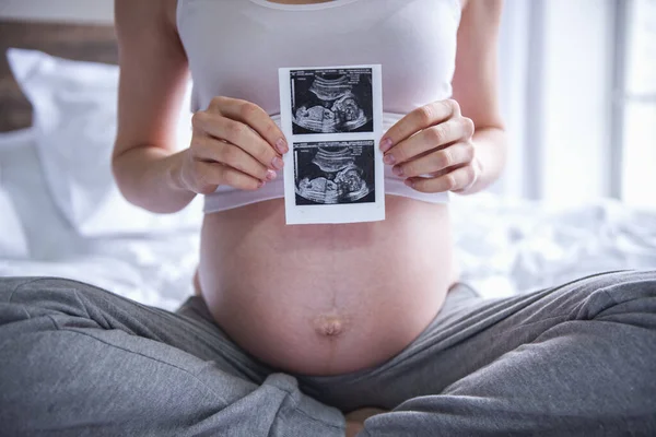 Oříznutý Obraz Krásné Těhotné Ženy Držící Sonogram Zatímco Sedí Posteli — Stock fotografie