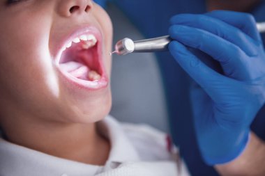 Sevimli küçük çocuğun diş tedavi diş hekimi Close-Up